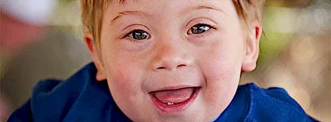 Engelli Olmak Pilates Yapmayı Engeller mi?